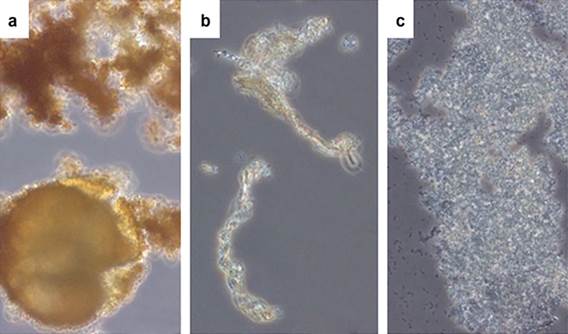 خوردگی میکروبی در مبدل حرارتی — تصویر SEM از بیوفیلم و پیتینگ